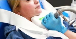 How to lose neck fat CoolSculpting