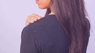 helps eliminate dandruff