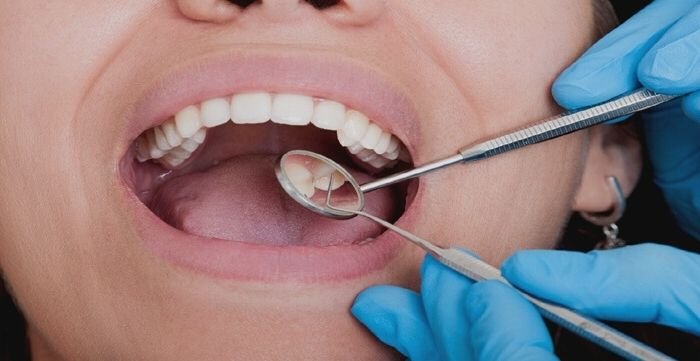 why you need regular dental check ups 