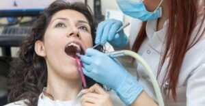 dental implants