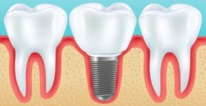 finding the right periodontist