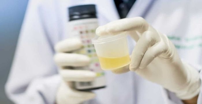 diluting_urine_samples