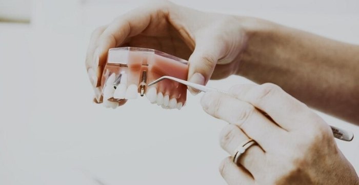 intra oral dental cameras