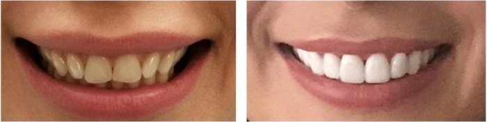 dental treatment abroad