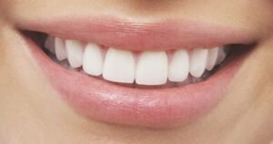 how long does teeth whitening last