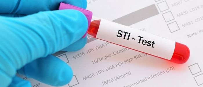 telehealth for STIs screening