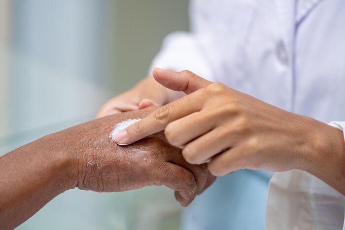 autoimmune diseases and treatment options