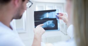 requirements for bone spur removal