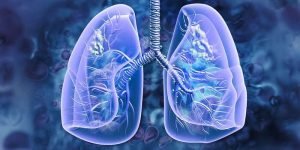 lung cancer screening Singapore