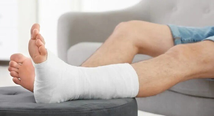 how to exercise with a broken ankle