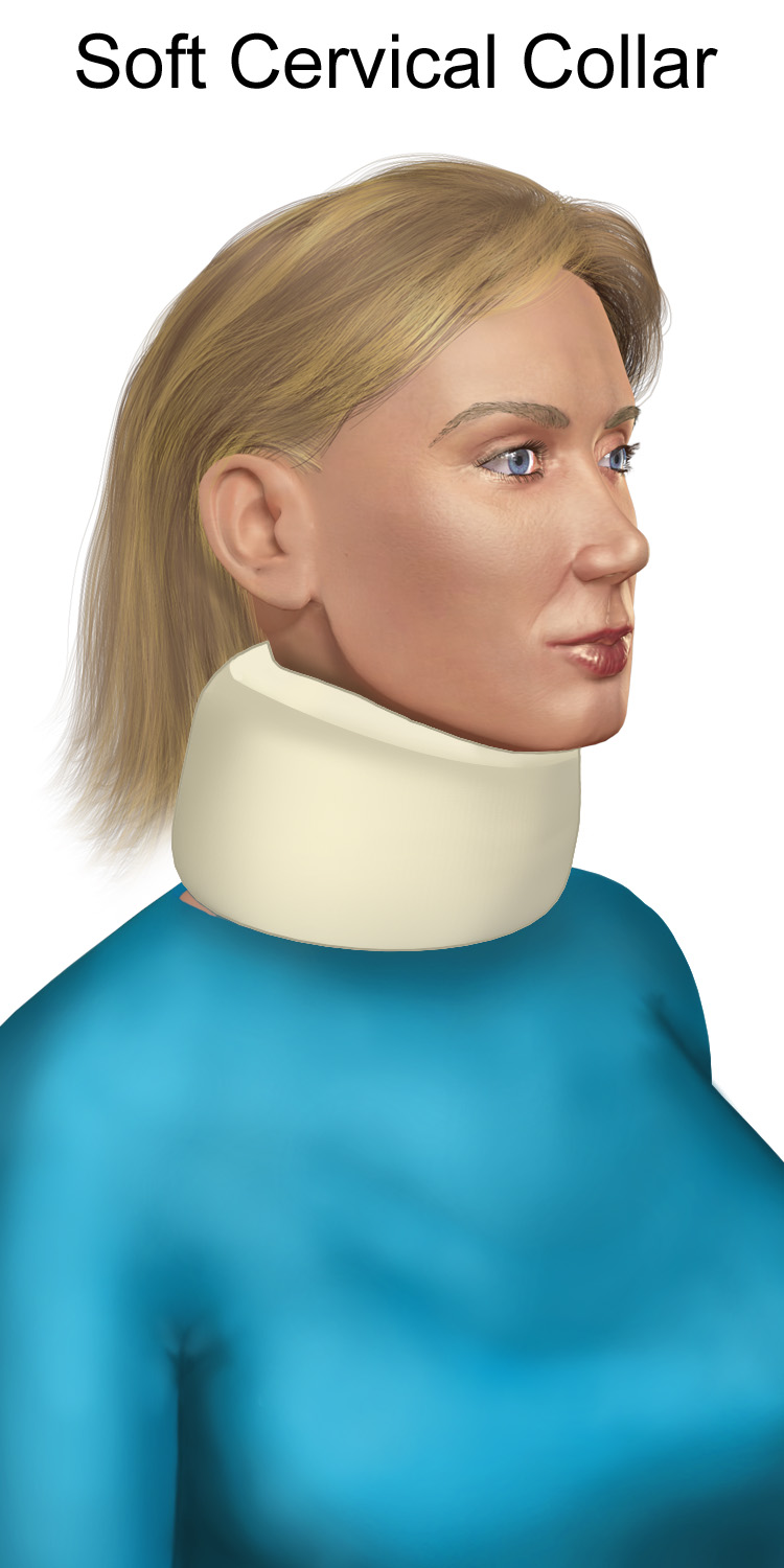 Illustration of a soft cervical collar neck brace, the type commonly used to learn how to sleep with a neck brace